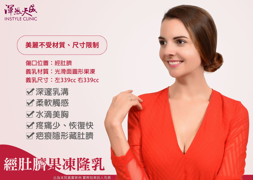 法國女模隆乳紀錄,隆乳心得,渾然天成隆乳,經肚臍隆乳
