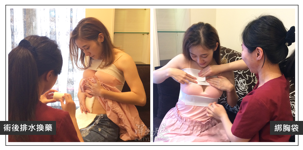 豐胸,隆乳,隆乳實錄,隆乳心得,隆乳效果,豐胸辦法,平胸困擾