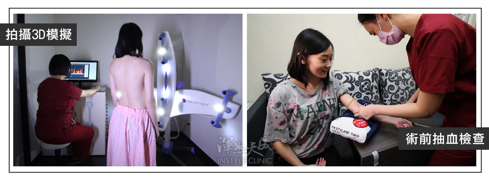 豐胸,隆乳,隆乳實錄,隆乳心得,隆乳效果,豐胸辦法,平胸困擾