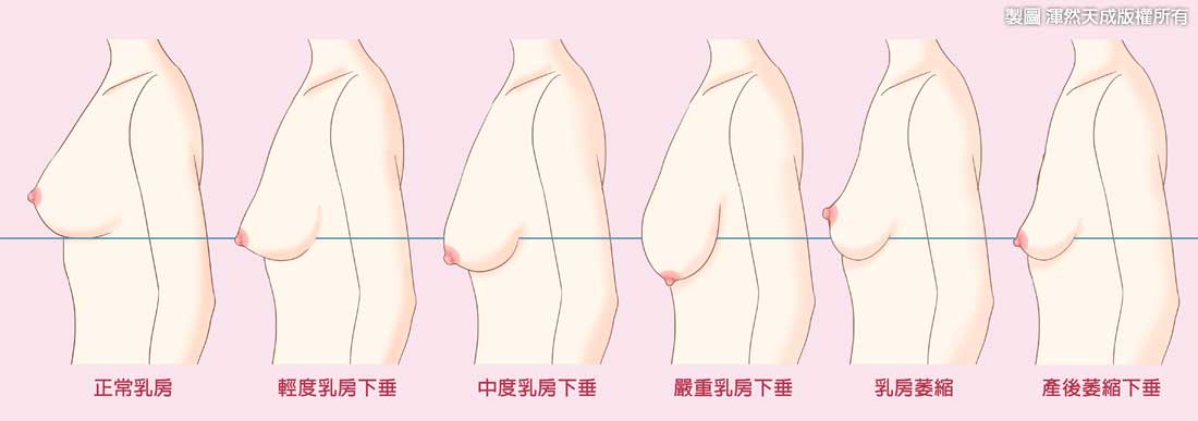 怀孕胸的变化下垂图片